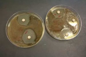חיידקים, עובש ופטריות במערכת המיזוג? חיטוי המזגן – כיצד עושים זאת?